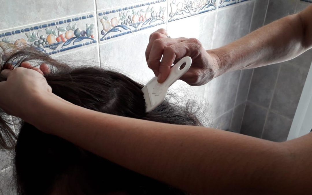 Derribando falsos mitos sobre los piojos