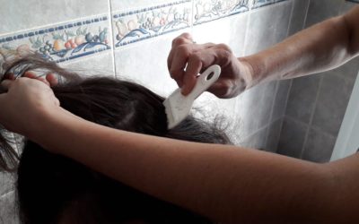 Derribando falsos mitos sobre los piojos