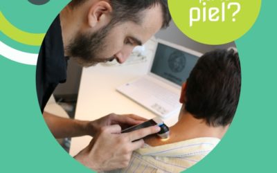 ¿Preocupado por tu piel? Acude a Telederma en Sanafarmacia