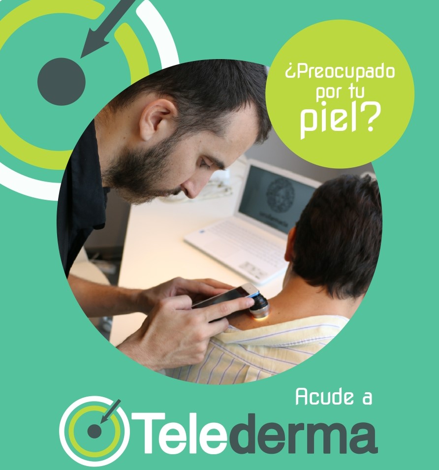 Telederma